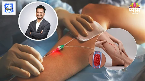 Varicose veins treatment