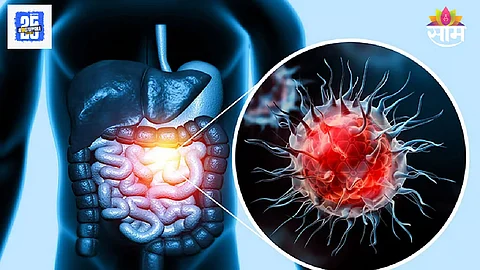 AI will detect the risk of cancer