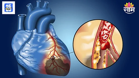 Inflamed heart symptoms
