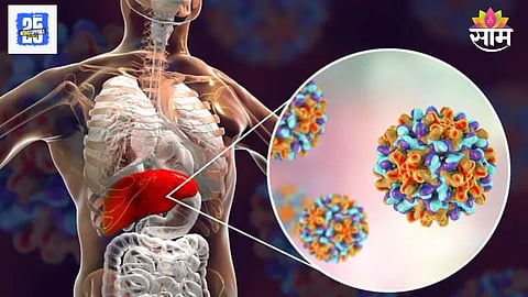 Liver disease