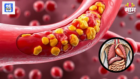 High Cholesterol affects Body