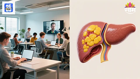 Fatty liver disease IT sector