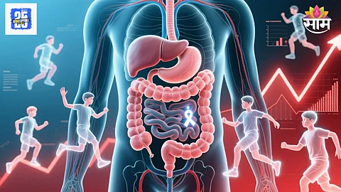 Symptoms of bowel cancer
