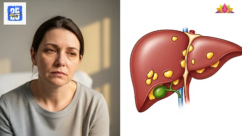 Fatty liver symptoms in women