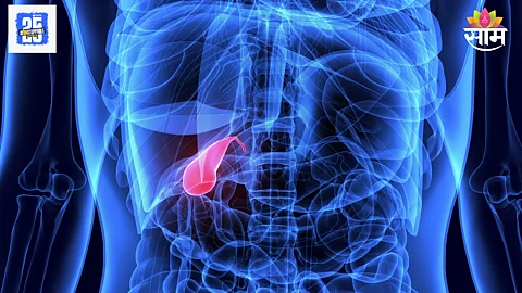 Gallbladder Cancer