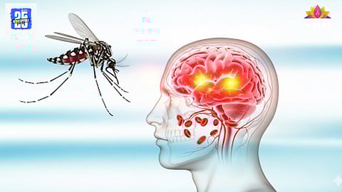 Dengue encephalopathy symptoms