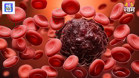 Blood cancer symptoms