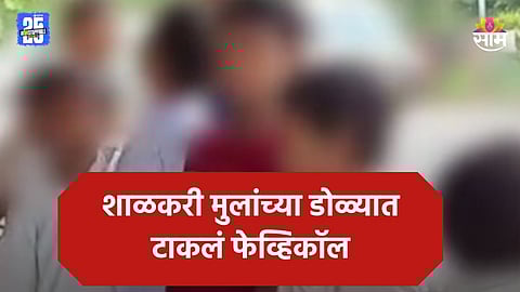 Shocking News: वर्गमित्रांचं भयंकर कृत्य! झोपलेल्या मित्रांच्या डोळ्यात टाकलं फेव्हिकॉल, ८ मुलांचे डोळे चिकटले