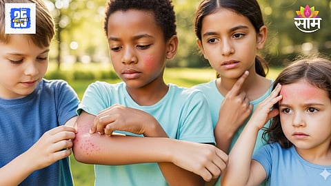 Childhood skin diseases