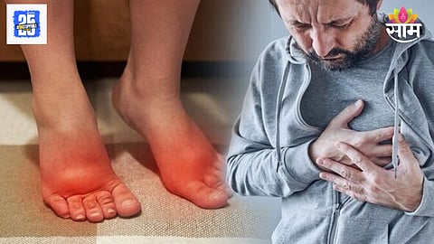 Leg symptoms of heart problems