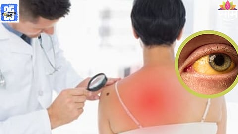 Cholesterol Symptoms: त्वचेवर ही ५ लक्षणे दिसल्यास व्हा सावध! असू शकतो उच्च कोलेस्ट्रॉलचा धोका