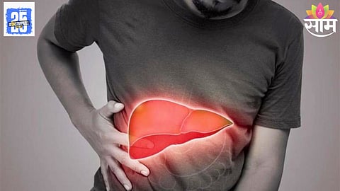 Liver Cirrhosis Symptoms