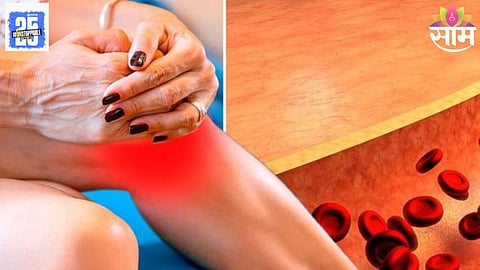 walking signs of cholesterol