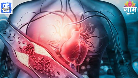 heart attack signs