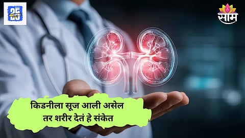 Swollen Kidney Symptoms