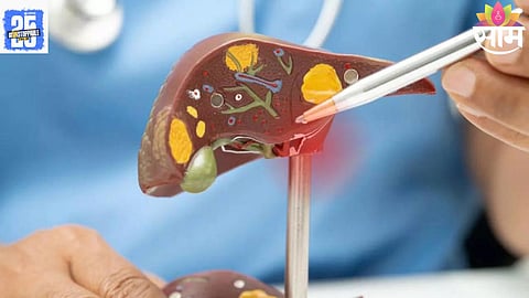 liver failure symptoms