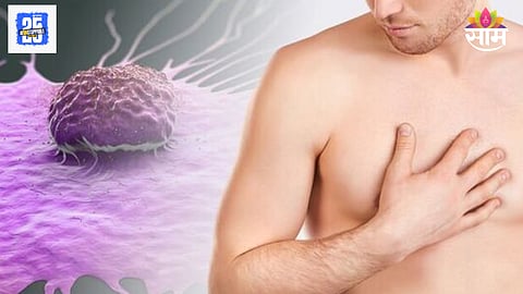Male breast cancer signs
