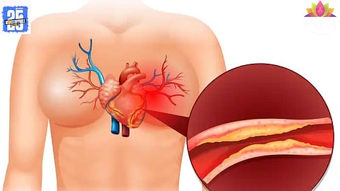 Pumpkin Seeds For Cholesterol