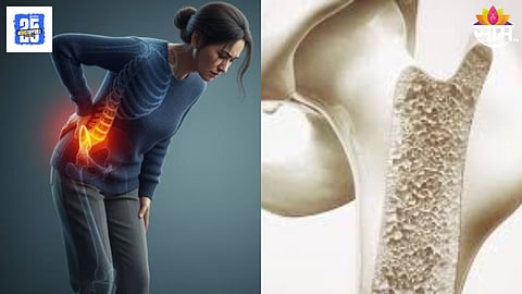 Best Foods for Strong Bones