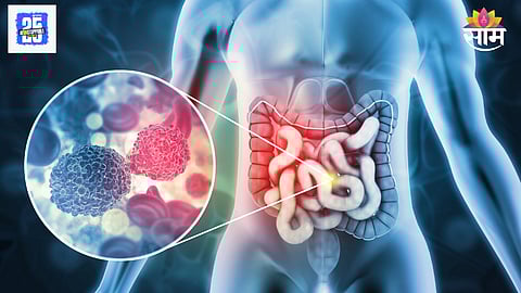 skin signs cancer risk