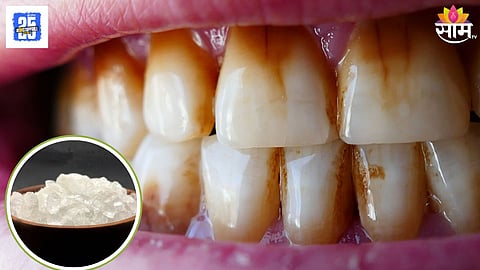 Remove Bad Breath and Yellow Teeth Naturally