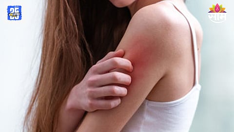 Diabetes skin symptoms