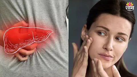 Face And Liver Connection