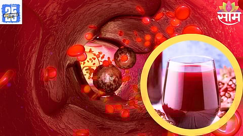 foods causing colon cancer