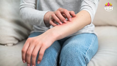 Warning Signs Of High Blood Sugar On Skin