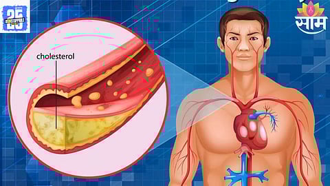 Cholesterol Reducing Foods Hidden in Your Kitchen