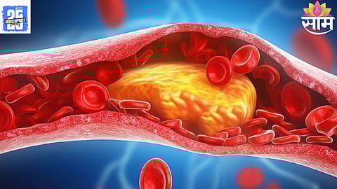 coconut milk cholesterol