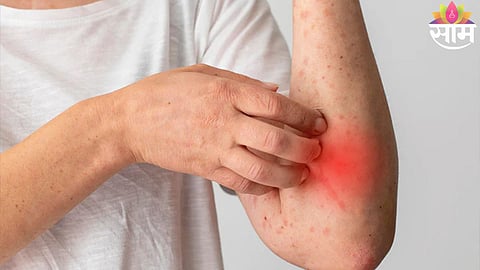 Skin Cancer Warning Signs