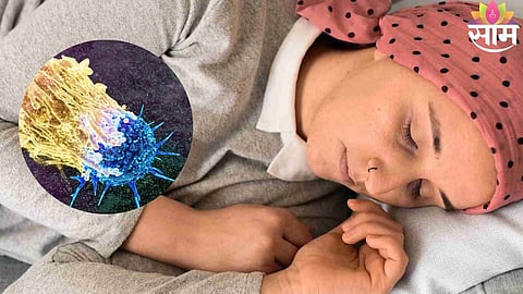 Cancer Patients Sleep Problems