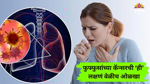 Lung Cancer From Mild Cough