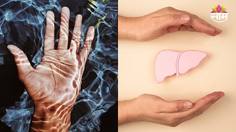 liver disease symptoms