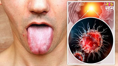 Colon Cancer symptoms