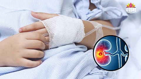 Pediatric Kidney Cancer