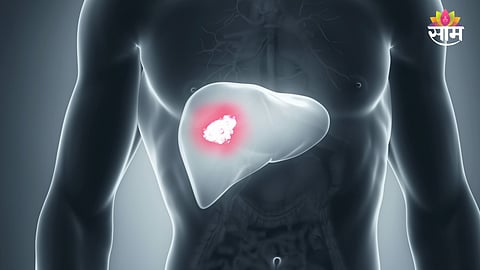 Early symptoms of liver tumor
