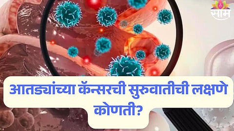 Colorectal Cancer Symptoms