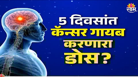 Fact Check: ५ दिवसांत कॅन्सर गायब करणारा डोस? एकाच डोसने गाठी पूर्णपणे नष्ट?