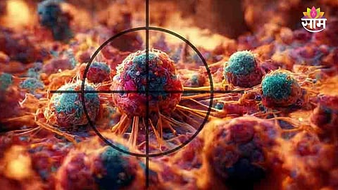 Blood cancer symptoms