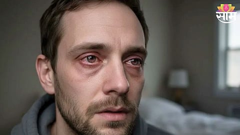 AIDS Warning Signs Male