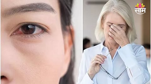 Menopause eye health