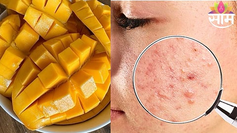 Mango Side Effects On Skin