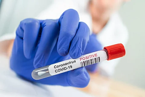 Test positive for corona vaccine?