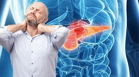 5 أعراض "شائعة" تنذر بسرطان البنكرياس.. تستحق الانتباه