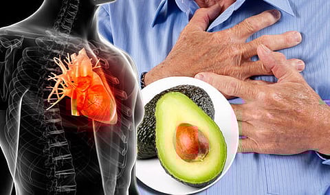 حبتان من الأفوكادو أسبوعيًّا تُقلل مخاطر الإصابة بأمراض القلب بنسبة 20%