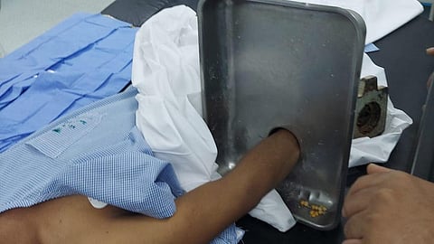 شاب يعمل في أحد المطاعم على الفرامة عندما علقت يده داخلها