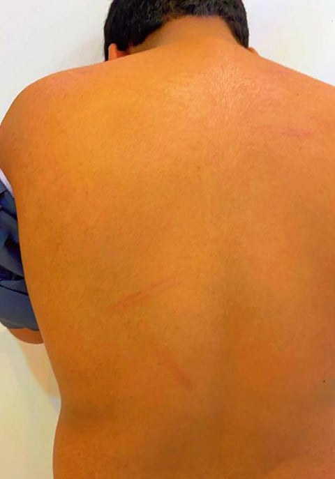 تضرَّر طالب بإحدى المدارس المتوسطة في الطائف