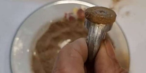 عواصف التراب تضرب الجهاز التنفسي.. خبراء: الغبار محمل بالمعادن والعوالق الضارة